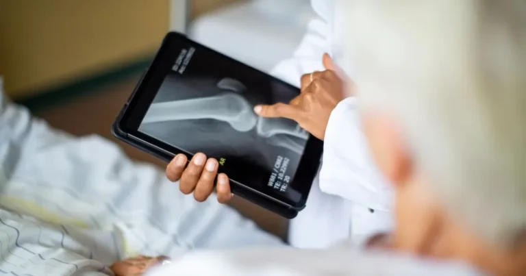 Indonesia menyetujui penggunaan kecerdasan buatan (AI) untuk skrining osteoporosis asal Taiwan